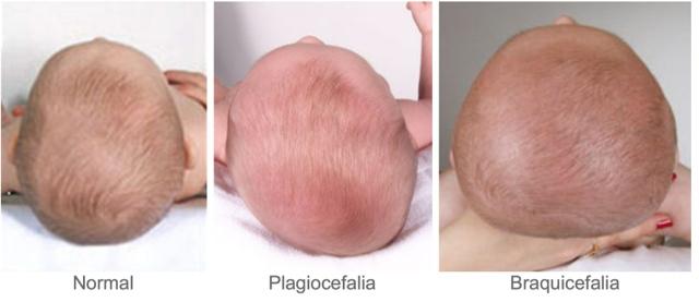 81189-COJIN JANE PLAGIOCEFALIA(20-4)-2